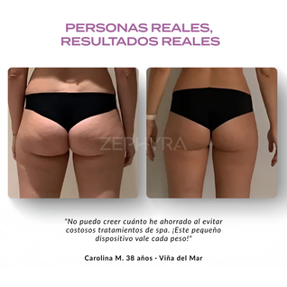 CeluLift Pro + Crema de Regalo